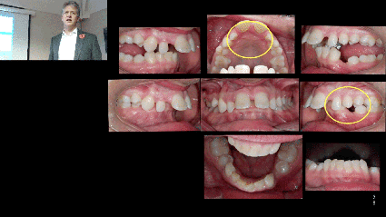 Register for our study clubs which count as two hours of verifiable CPD. image of dentistry study club