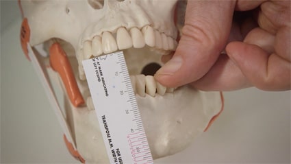 image of occlusal examination pg dental course